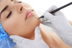 3 Reasons Why Plastic Surgeons Recommend Collagen Supplements